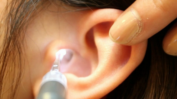 Can YOU hear THIS hissing noise? Tinnitus...and how to live with it
