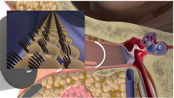 How Hearing Loss Occurs